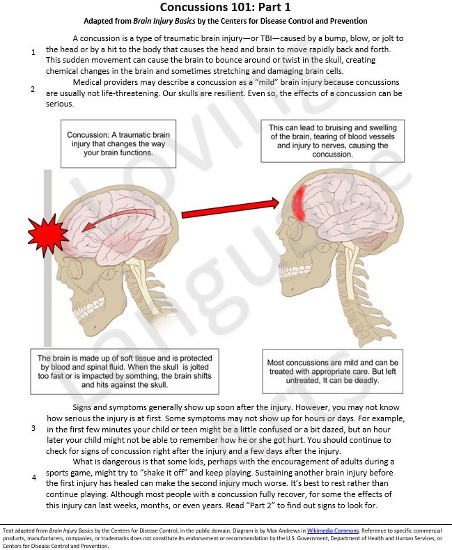 informational text concussion basics